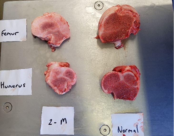 An image showing the difference between normal bones and bones affected by long bone disease